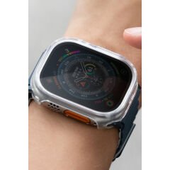 Uniq Apple Watch 45mm Garde Kasa Cam Ekran Koruyucu Füme